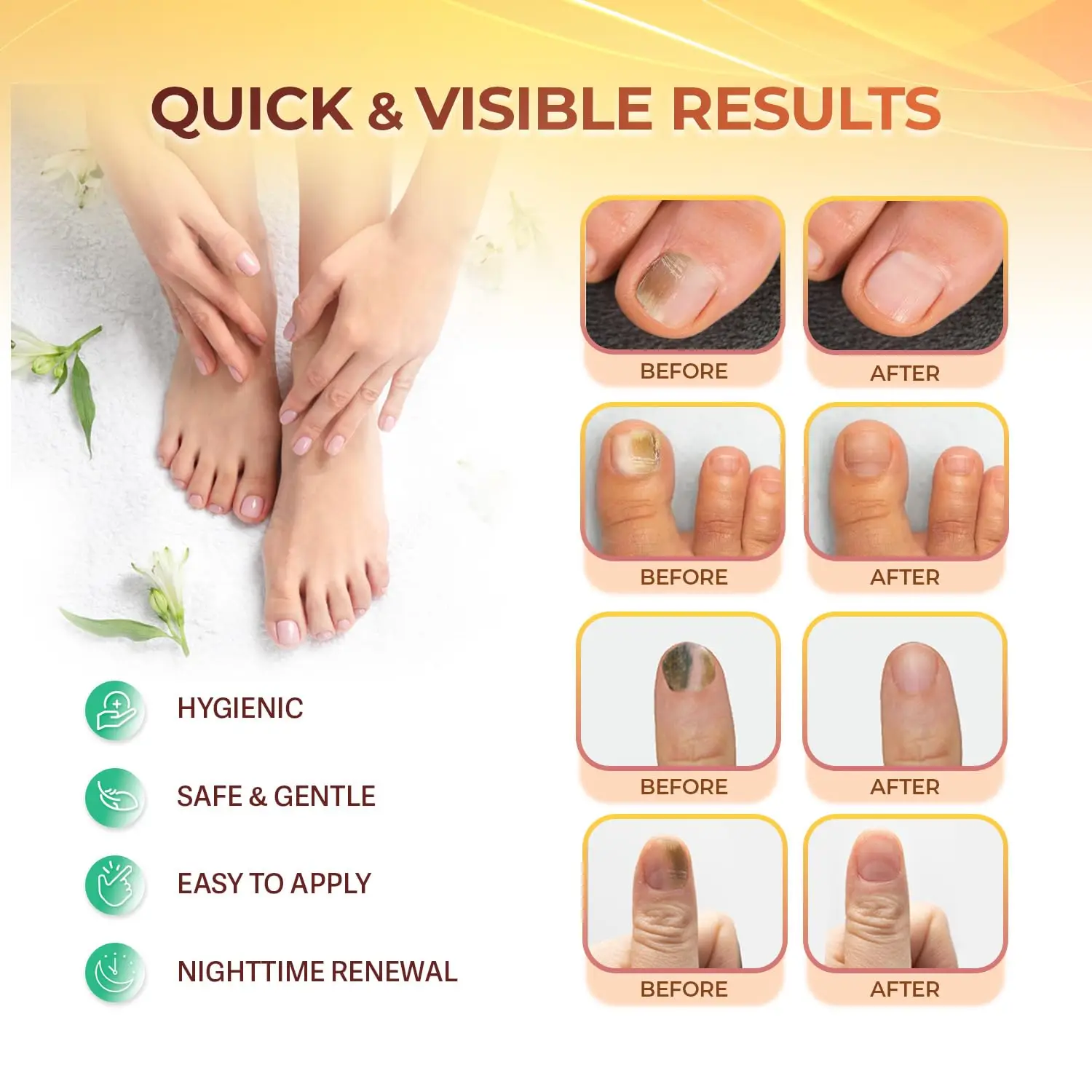 64/32 PCS Foot Fungal Nail Patches ToeNail Anti Infection Fungus Treatment Sticker Improve Damaged Nails Personal Body Care Tool