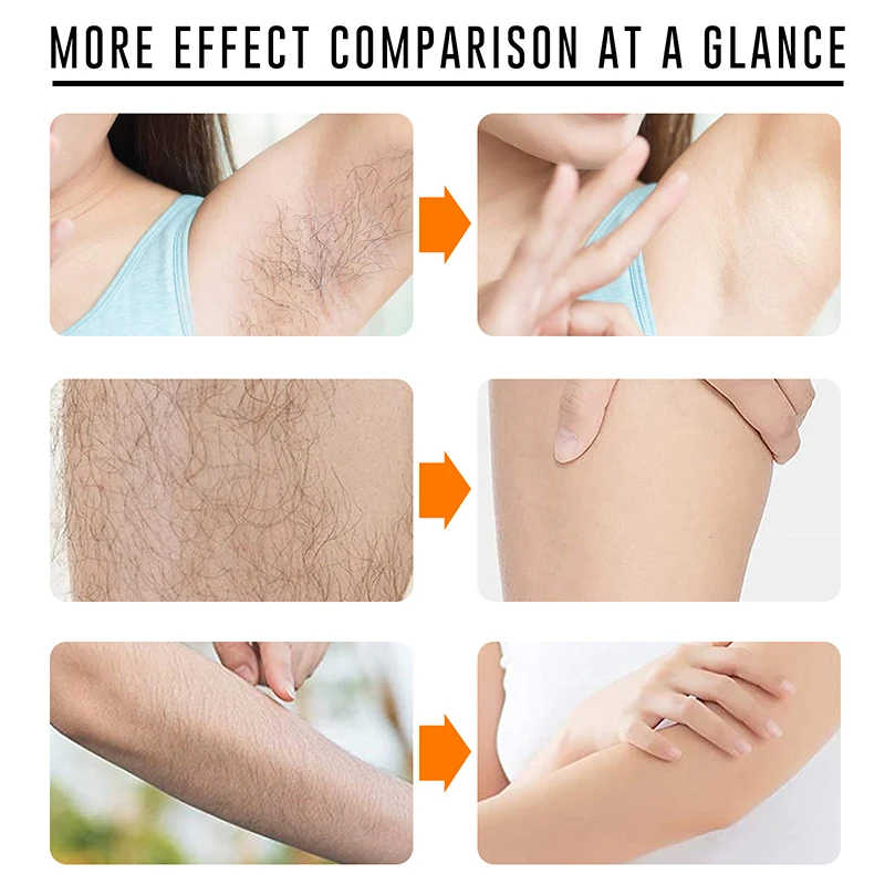 2 Minutes Fast Hair Removal Spray Painless Hair Growth Inhibitor Leg Arm Armpit Permanent Depilatory for Ladies Men Repair Care 3