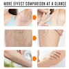 2 Minutes Fast Hair Removal Spray Painless Hair Growth Inhibitor Leg Arm Armpit Permanent Depilatory for Ladies Men Repair Care 3