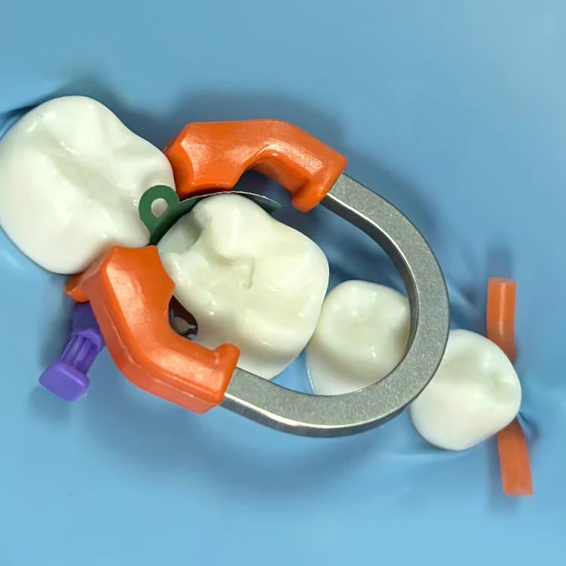 Guarnizione Pacco Lamellare Fasce A Matrice Dentale Anello Morsetto - Ricambio Per Sistema Garrison Palodent V3, Ideale Per Laboratori Fasce Per Otturazioni Composite - Foto 4