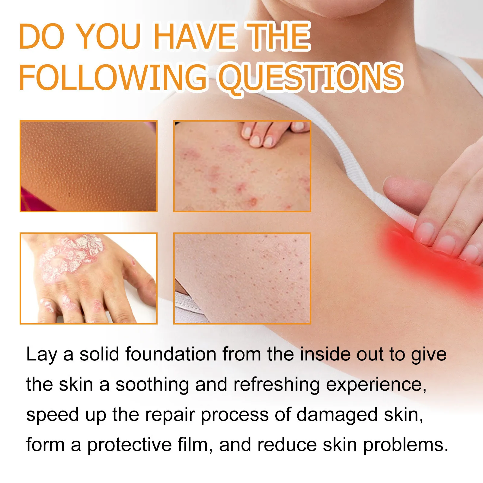Seborrheic Dermatitis Spray Psoriasis Eczema Fungal Treatment Repair Itching Skin Redness Soothing Eczema Antibacterial Spray
