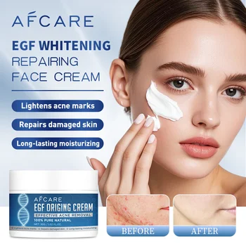 Acne Cream Salicylic Acid Oligopeptides Repair Acne Marks Spots Deep Day Cream