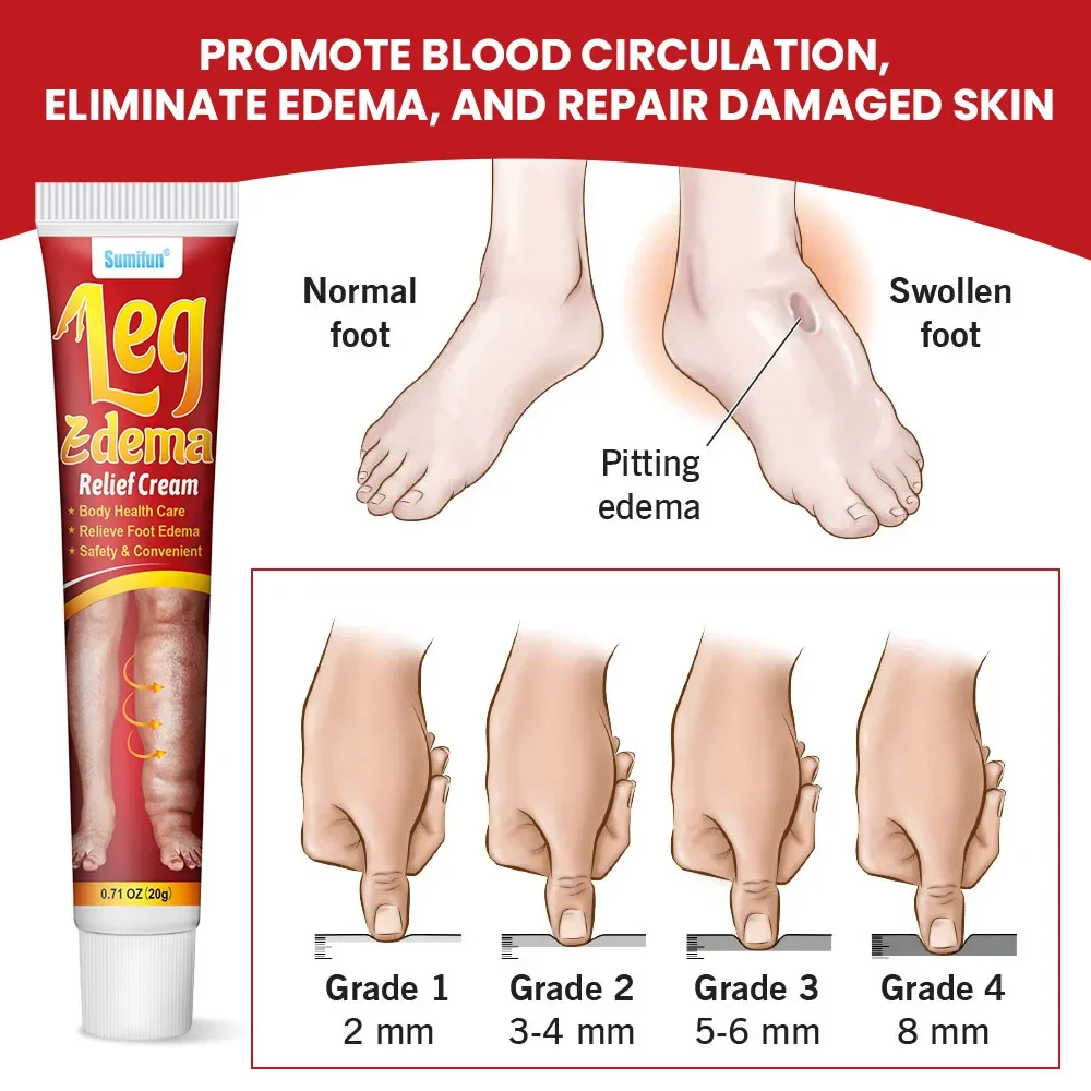 20g Leg Relief Cream For Circulation Relieve Foot Edema Massage Cream For Swollen Legs And Ankles Body Health Care personal health care,pain analgesic cream