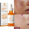 Vitamin C Whitening Serum Face Remove Dark Spots Freckles Fade Melanin Retinol Anti-wrinkle Essence Brightening Korean Skin Care 1