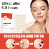Hydrocolloid Patches for Pimples (2 Sizes) – Invisible and Compatible with Makeup