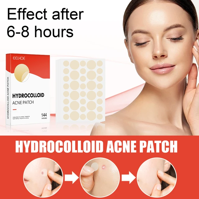 Hydrocolloid Patches for Pimples (2 Sizes) – Invisible and Compatible with Makeup