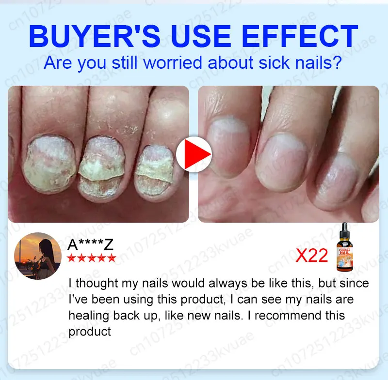 Description Picture 5 of itemnail