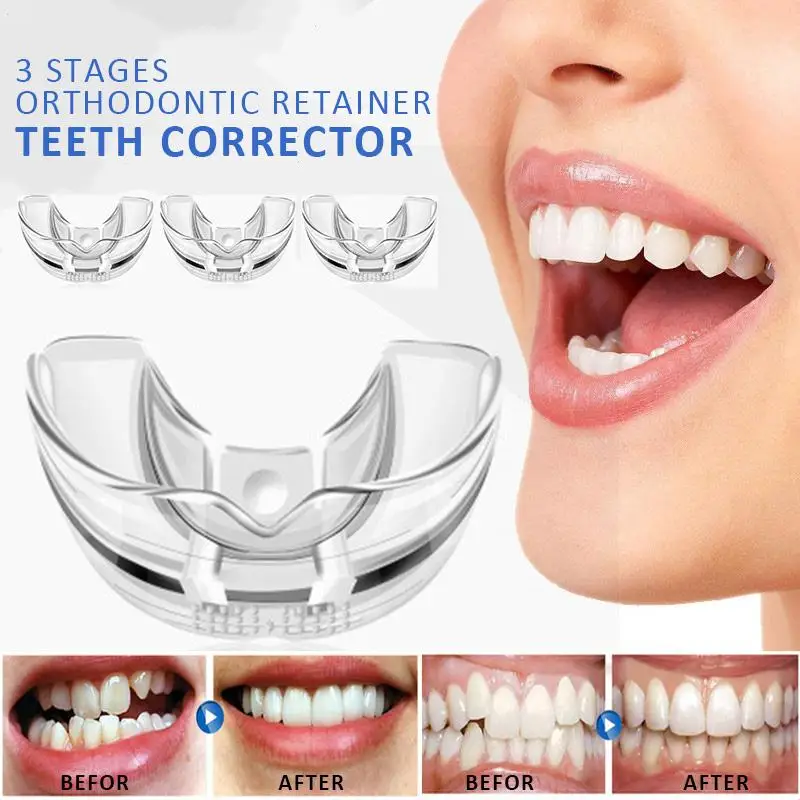 

3 Stages Dental Orthodontic Braces Appliance Braces Alignment Trainer Teeth Retainer Bruxism Mouth Guard Teeth Straightener