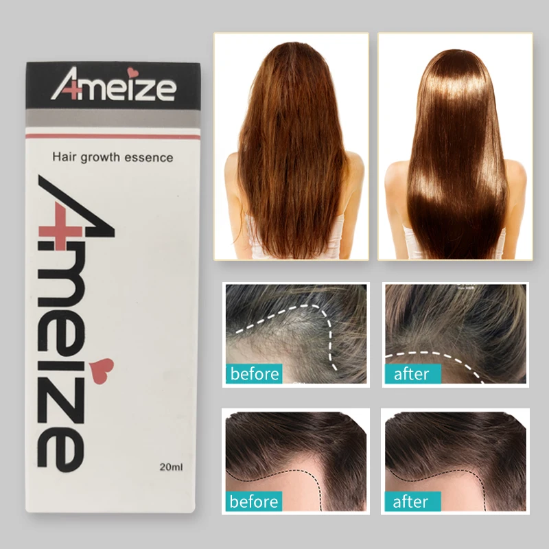 Hair Growth Essence Shampoo Mate 5Pcs Hair Regenerating Oil Reduce Loss Liquid 20ML