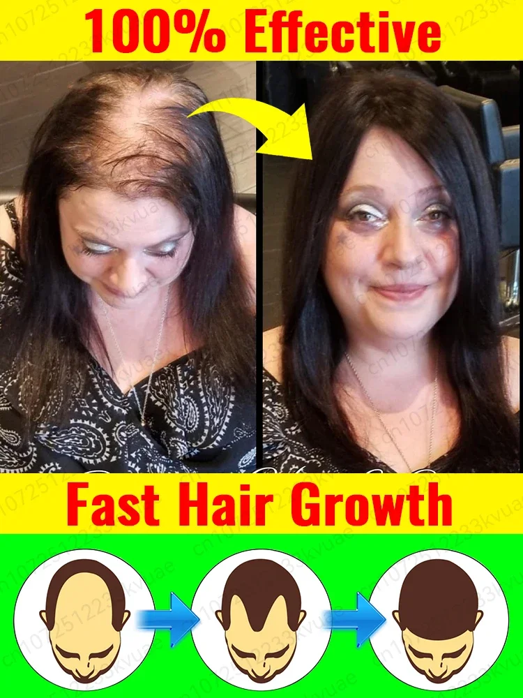 Rapid hair growth essential oil, repair baldness