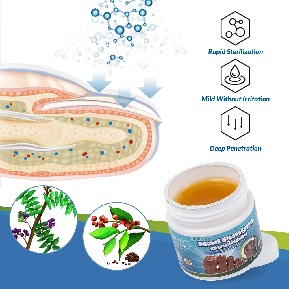 20G/box Sumifun Nail Fungus Treatment Cream Herbal Extract Paronychia Onychomycosis Repair Ointment Anti Infection Foot Care antibacterial anti fungal cream,nail fungus treatment patches