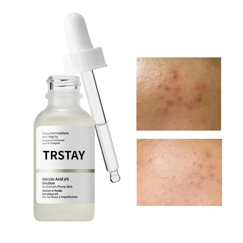 

Salicylic Acid 2% Solution Essence Acne Spot Removing Shrink Pores Oil-Control Brighten Face Skin vitamin c serum for face