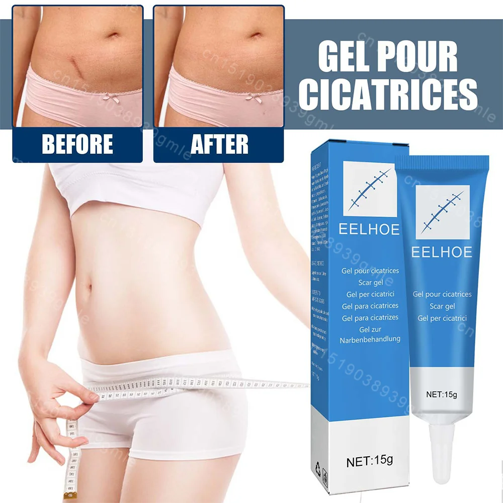 Scar repair gel fast recovery surgery Scar treatment Spot repair Soften stretch mark Burn Whitening body care Relief