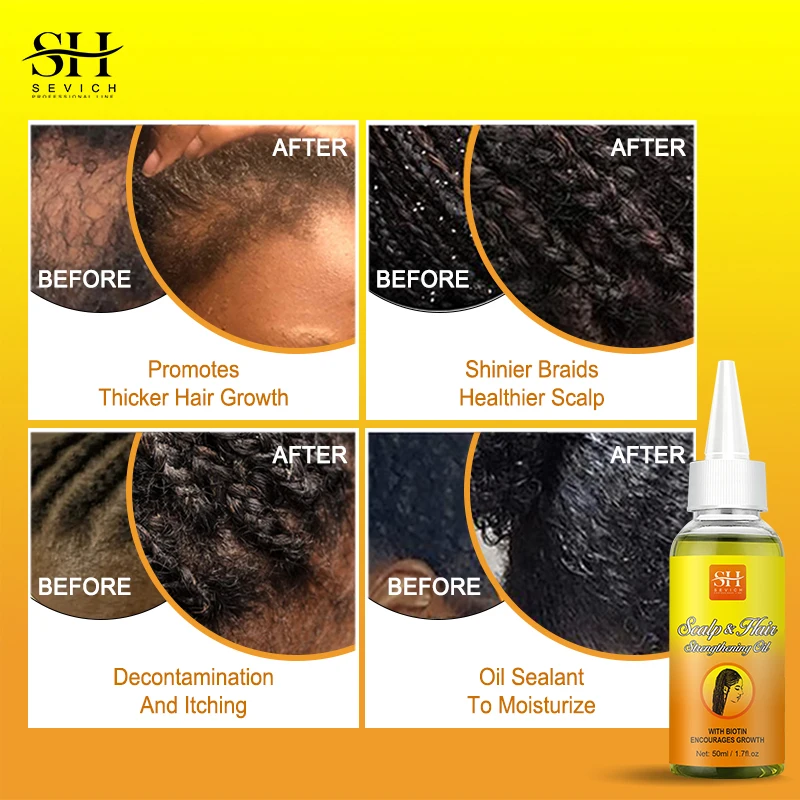 Anti Break Hair Styling Braiding Gel Edges Control Hair Shaping Cream Anti Hair Loss Braid Wax Hair Growth Oil Sevich Hair Care 3