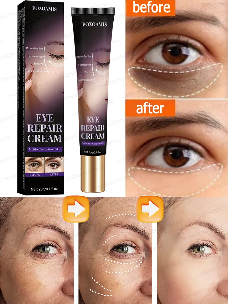Effective eye cream eliminates wrinkles eye bags dark circles tightens skin brightens skin in 7 days beauty enhancement product