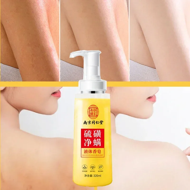 

gentle mite-removing oil-controlling mite-removing shower gel is deeply clean acne-removing refreshing Sulfur liquid soap