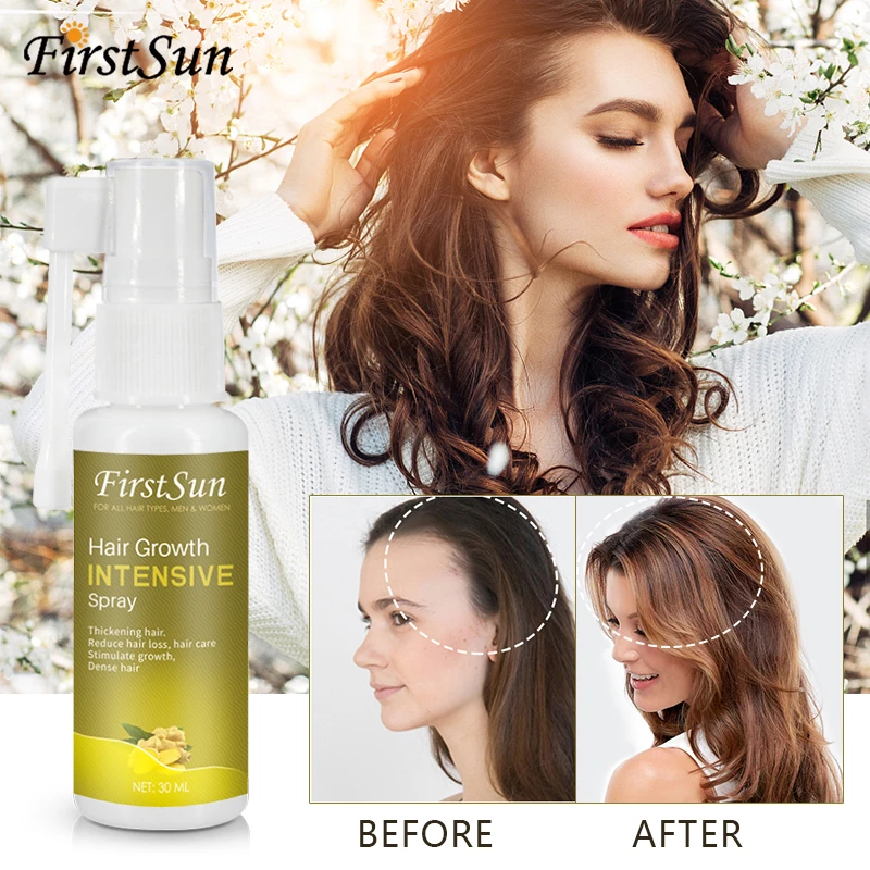 30ml New Hair Growth Spray Fast Ginger Essence Oil Hair Loss Treatment  Preventing Hair Lost Alopecia Cure Care Serum - Hair Loss Product Series -  AliExpress