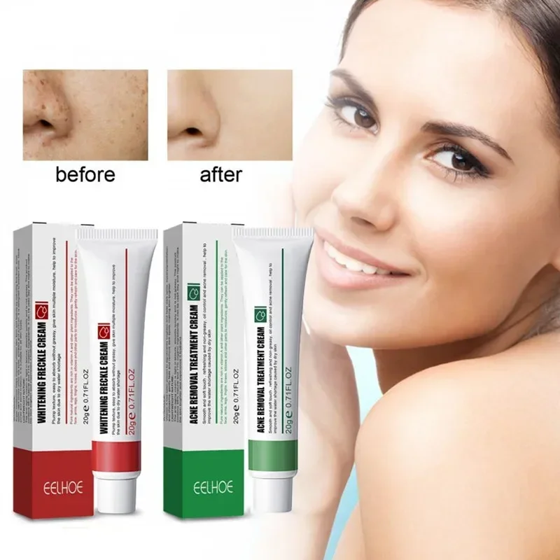 

Lightens Spots Brightening Serum Moisturizes Skin Whitening Cream Women Acne Anti-spot Cream Repair Brighten Skin Care Lotion