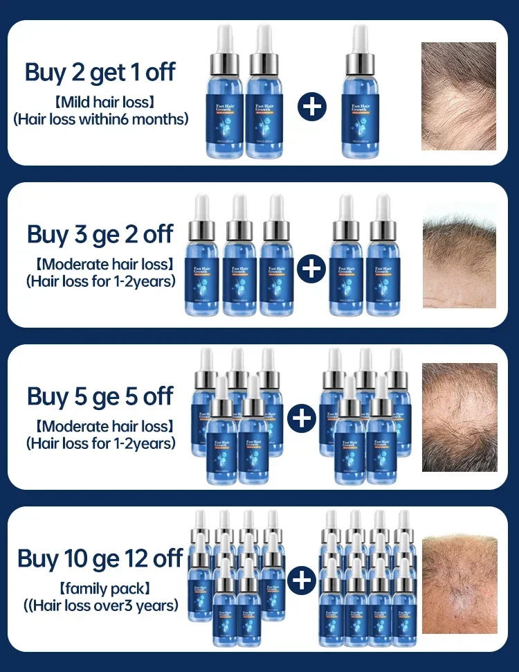 Hair Growth Oil Baldness Repair