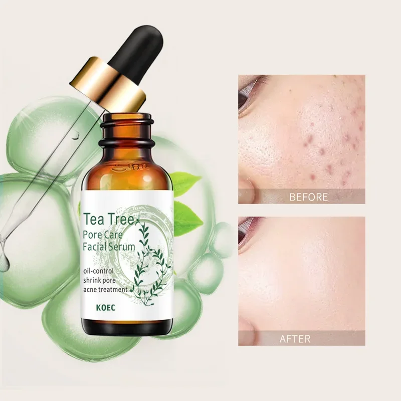 

Tea TreePore Care Facial Serum Clean your pores Remove acne and pimples Moisturizing the dry skin Smoothing the rough skin