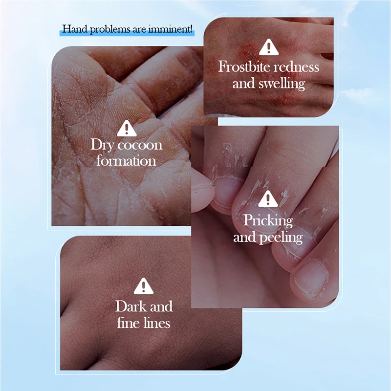 SADOER Coconut Moisturizing Hand Mask Whitening Nourishing Anti-aging Hydrating Hand Gloves for Hands Skin Care Products