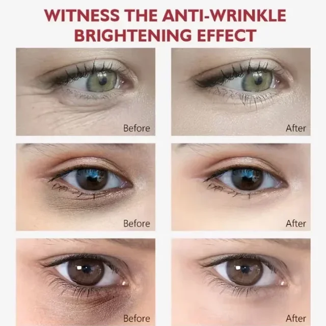 Retinol Eye Cream Collagen Multibalm Stick Reduce Wrinkles Eye Bag Hyaluronic Acid Anti Dark Circle Puffiness Eye Care Products 5