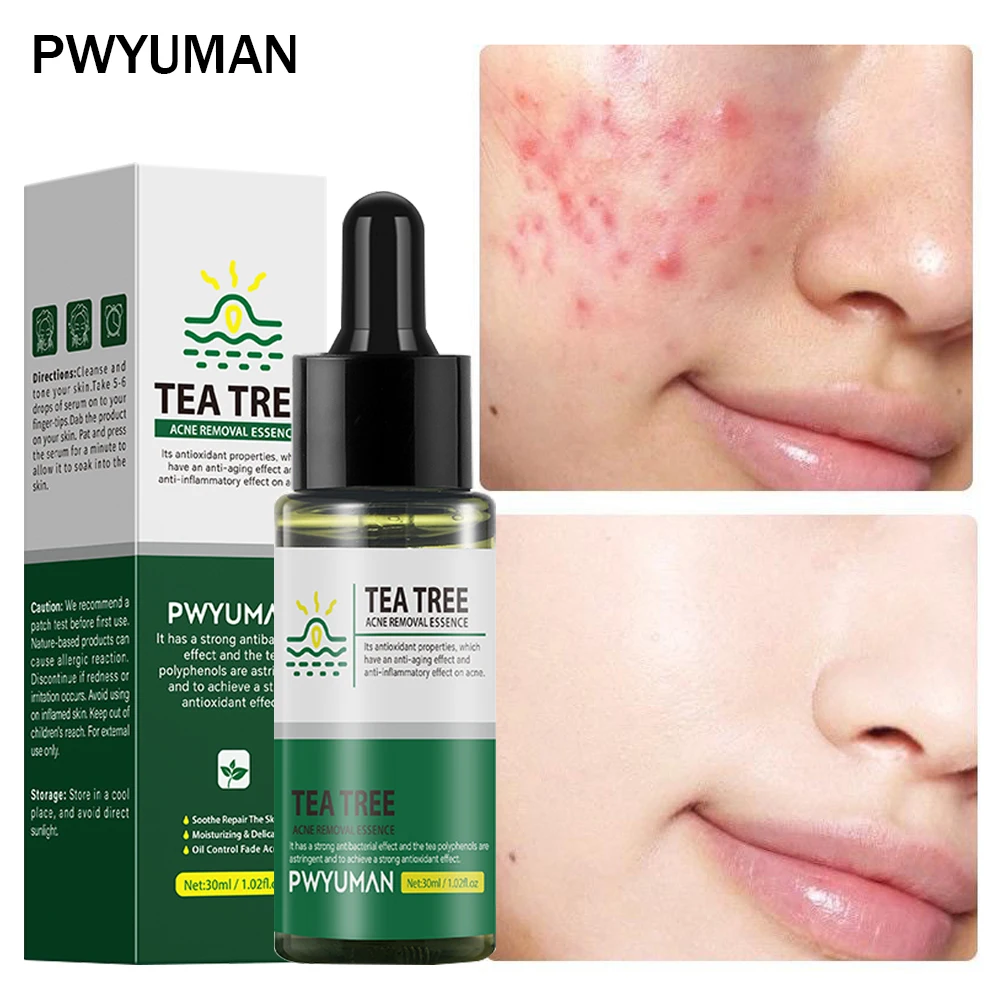 

Tea Tree Acne Removal Serum Treatment Acne Serum Shrink Pore Remove Blackheads Facial Cleaning Fade Acne Marks Whitening