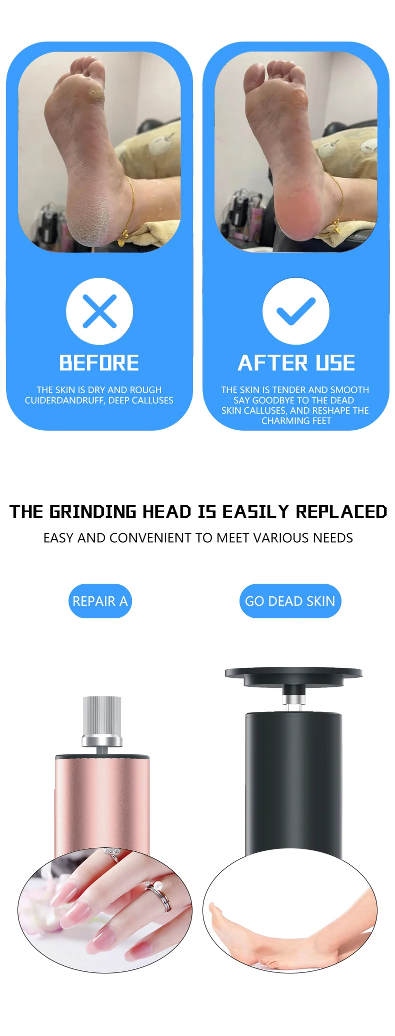 Description Picture 5 of itemCallus Remover Feet 6 Gears Foot Sandpaper File for Heel Pedicure Tool Recharegable Foot Dead Skin Remover Foot Corn Exfoliation