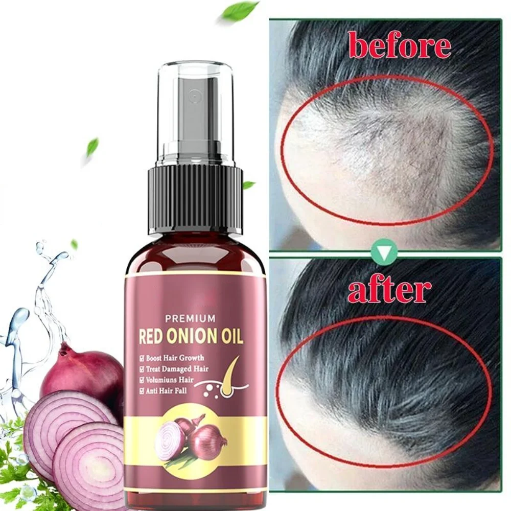 100NaturalHairGrowthEssentialOilsEssenceSprayAntiAlopecia