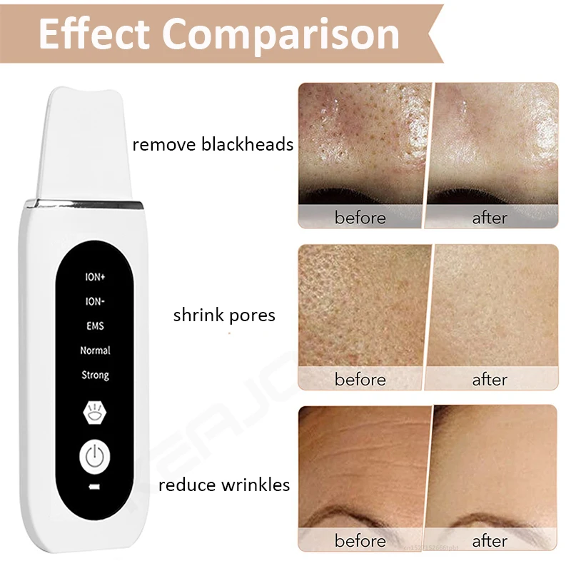 Ultrasonic Skin Scrubber Peeling Acne Blackhead Remover Ultrasonic EMS Ion Acne Pore Face Deep Cleaning Facial Shovel Cleaner 6