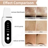 Ultrasonic Skin Scrubber Peeling Acne Blackhead Remover Ultrasonic EMS Ion Acne Pore Face Deep Cleaning Facial Shovel Cleaner 6