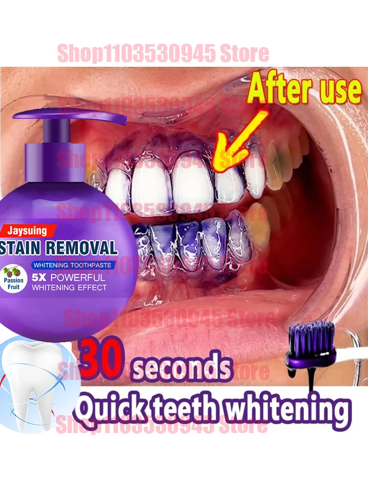 

Soda Toothpaste Teeth Whitening Cleaning Fight Bleeding Press Gums Toothpaste Flavors Hygiene Care Fruit Oral Toothpaste