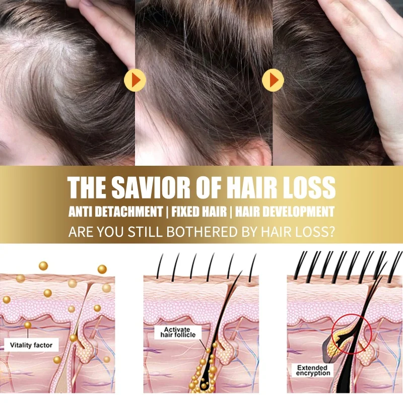 Scalp Treatment Fast Anti Exfoliating Scrub Remove Dandruff Anti Itching Seborrheic Scalp Oil Control Repair Scalp Beauty Health Care