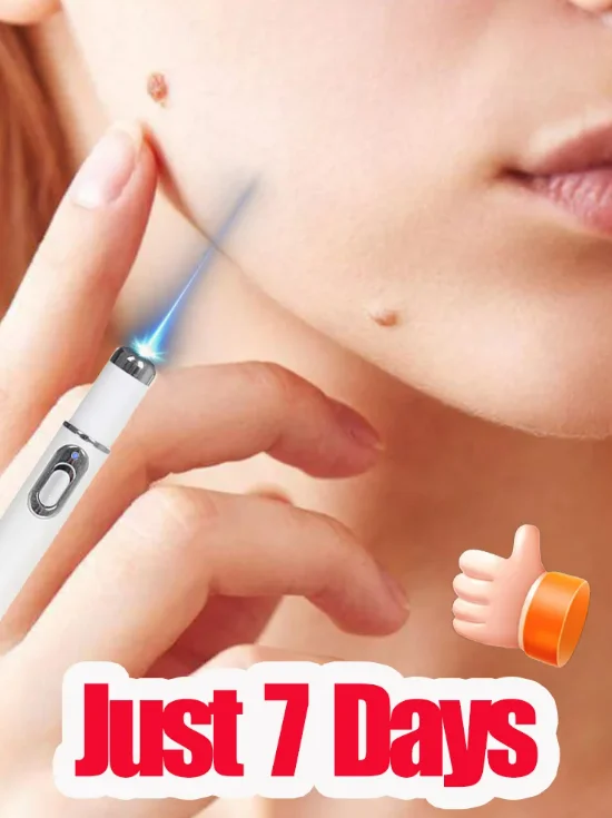 Portable Household Laser ᵂᵃʳᵗ ᴿᵉᵐᵒᵛᵃˡ Pen, ᶜˡᵉᵃʳ ᵂᵃʳᵗˢ All Over The Body_voghion.com