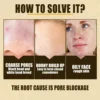 Pore Shrink Face Serum Remove Blackheads Acne Acidity Oil Control Repair Essence Moisturizing Nourish Pores Firming Facial Care 6