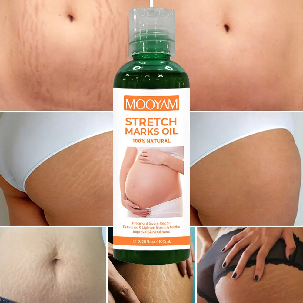 Stretch Mark Oil Pregnancy Oil Postpartum Repair & Removing Pregnancy Marks Oil Firming Body Massage Oil Skin care
