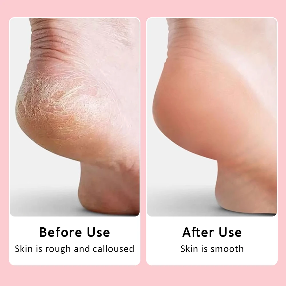 Electric Pedicure Machine Foot Grinder Pedicure Tools Foot File Callus Remover Skin Care for Heels Dead Skin Remover 3