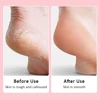 Electric Pedicure Machine Foot Grinder Pedicure Tools Foot File Callus Remover Skin Care for Heels Dead Skin Remover 3
