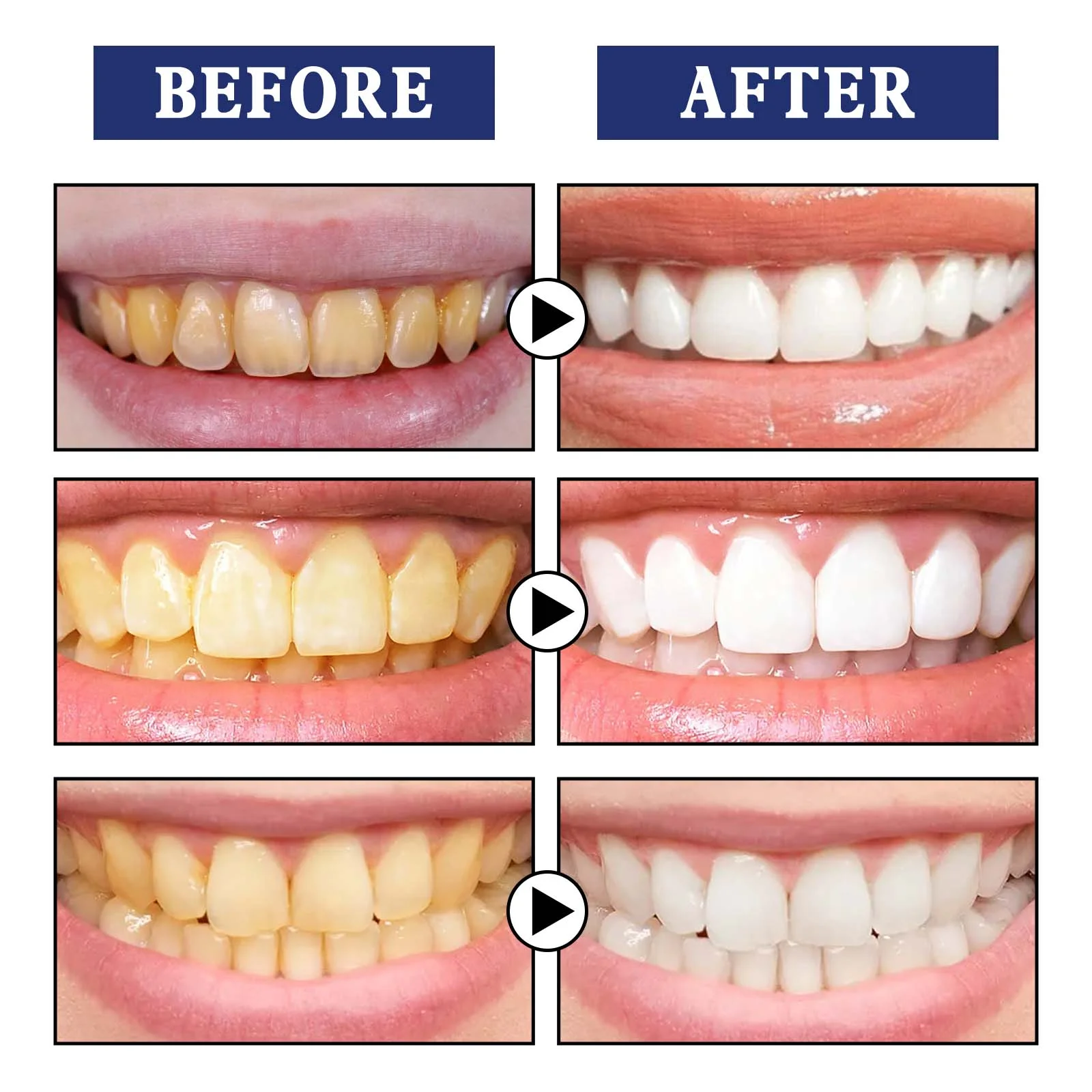 Teeth Whitening Serum Remove Plaque Stains Toothpaste Deep Cleaning Dental Oral Hygiene Tools Fresh Breath Tooth Care Products teeth whitening product teeth whitening essence