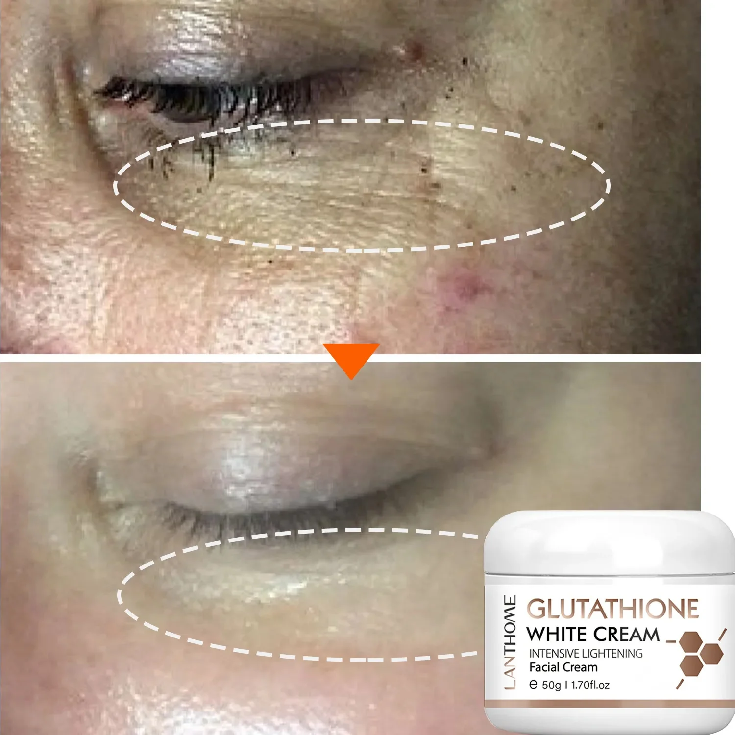 Glutathione Whitening Freckle Face Cream Remove Dark Spots Lighten Melasma Melanin Fade Acne Scars Anti-Aging_voghion.com