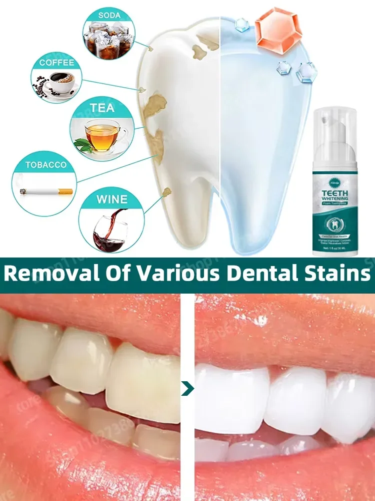 Whiter Teeth, Confident Smile