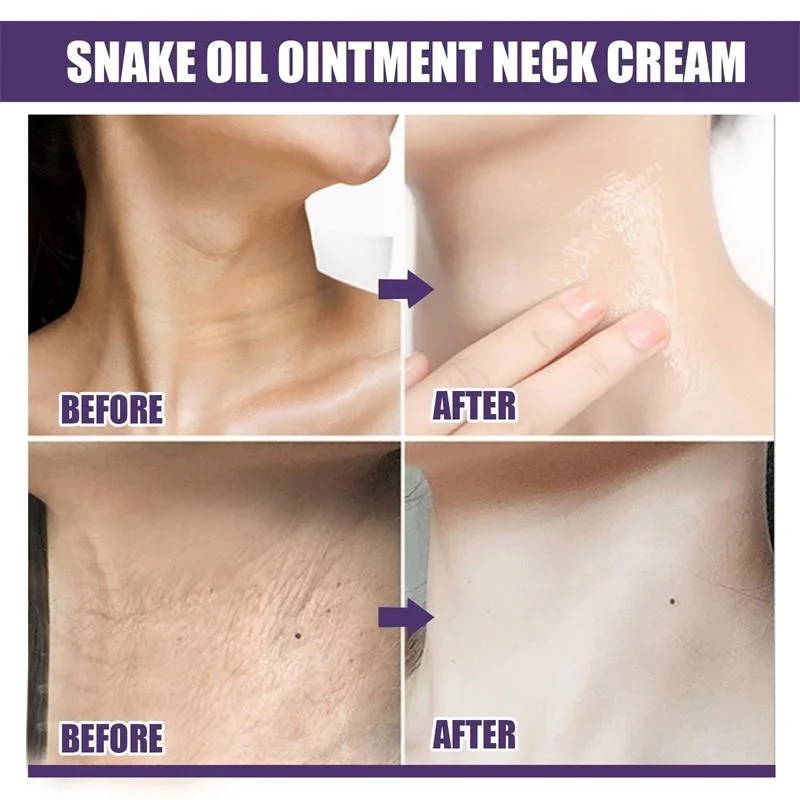 Neck Cream Moisturis Lift Neck Eliminate Double Chin Eliminate Fine Lines Anti-ageing Brightening Moisturizer