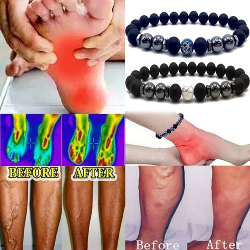 Magnet Anklet Colorful Stone eight Loss Magnetic Therapy Bracelet Slimming Health Care jewelry Weight Loss Product