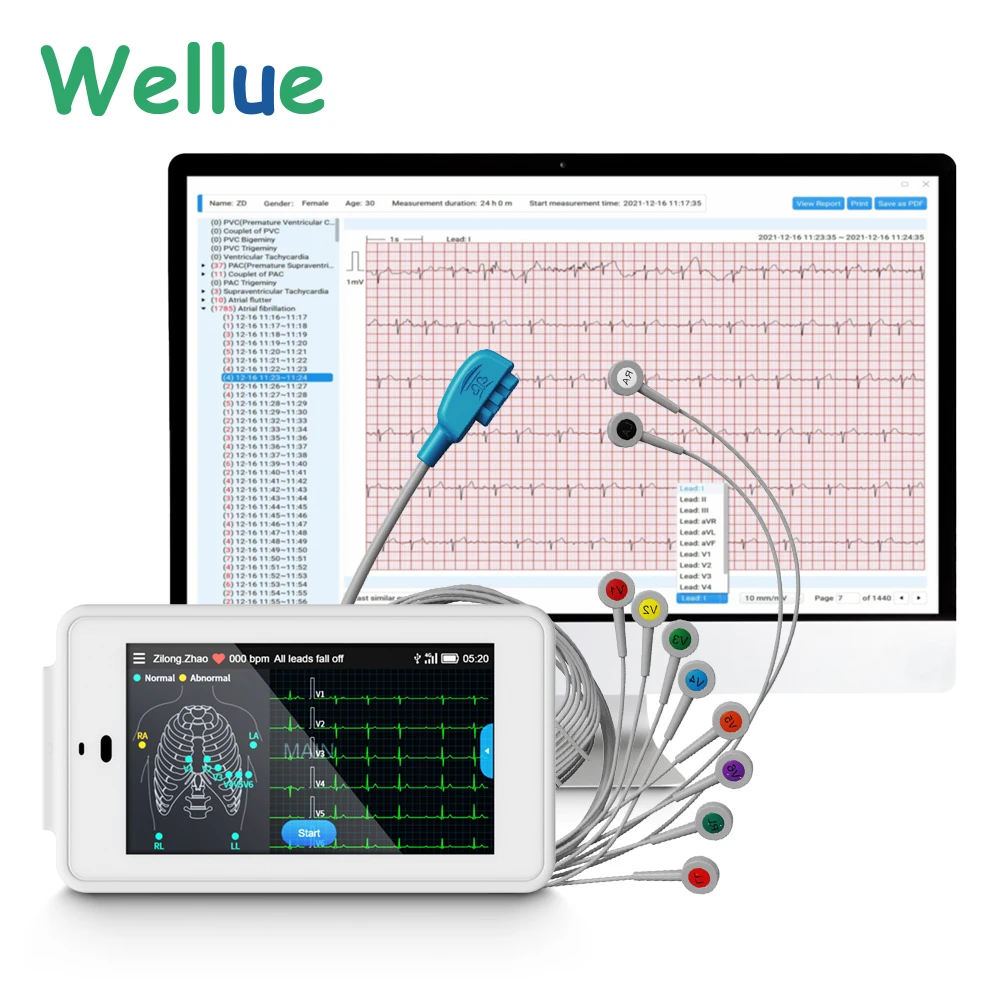 Wellue PC-ECG500 Pocket Ecg Monitor With Glasgow Analysis 6/12-lead Synchronous Acquisition Electrocardiography Ecg