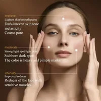 DPL Skin Rejuvenation Beauty Instrument 2025 New Stroboscopic Infrared Light Ice Feeling Painless Technology Girlfriend Gift 3