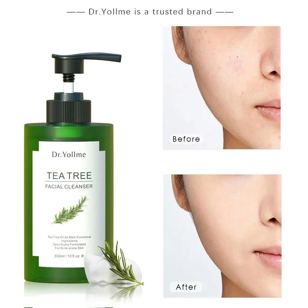 

300ml Tree Tea Facial Cleanser Mild Non Irritating Moisturizing Facial Cleanser Cleansing Pores And Repairing Barrier