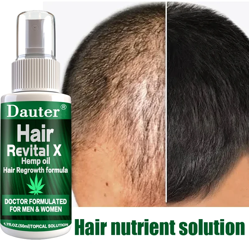 New Ginger Hair Growth Essential Spray Anti Hair Loss Serum 7 Da