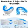Mouthpiece Anti Snore Mouth Guard Silicone Anti Snoring Bruxism Sleeping Aid Apnea Guard Teeth Snoring Device Stop Snore Oral 6