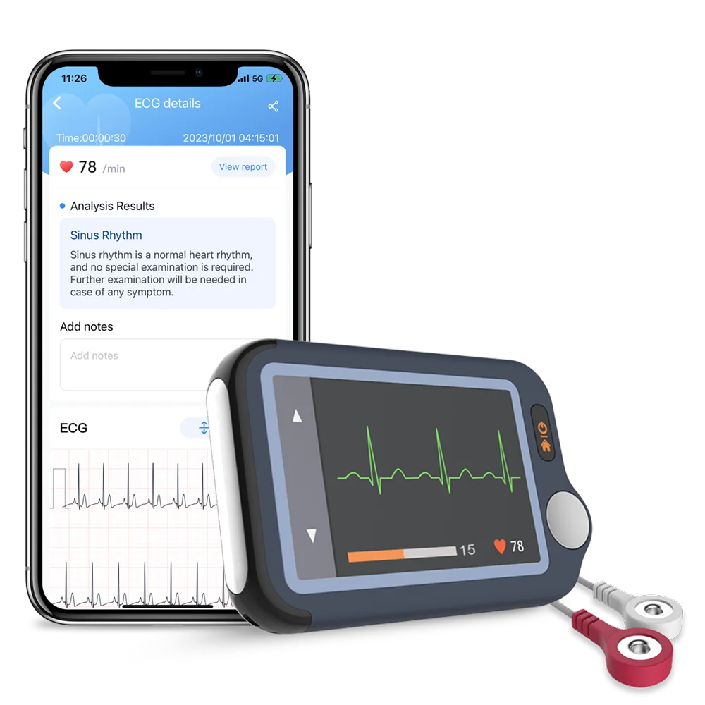 ECG/EKG Heart Monitor for Arrhythmia Afib 30s5min Measurement Support