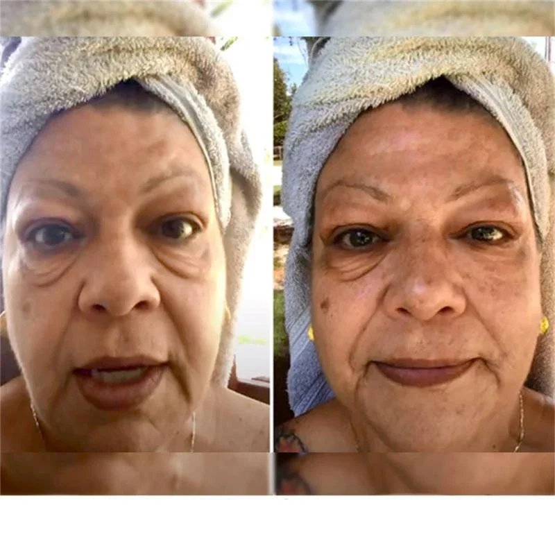 Wrinkle Eye Care Eye Bags Removal Eyes Cream Lifting Firming Temporary Bag Removal Dark Circles